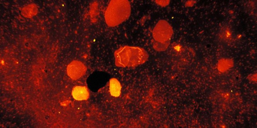 m-tuberculosis-is-an-acid-fast-bacterium-undetectable-when-stained-using-a-gram-stain-technique-725x490.jpg